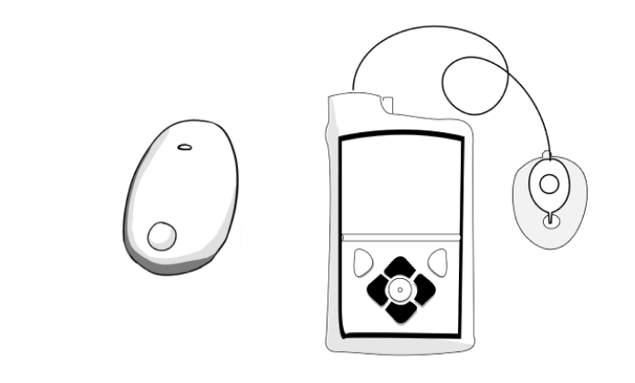 EversenseMedtronic 1